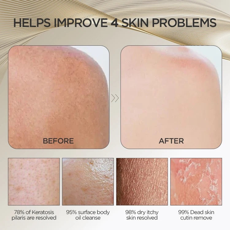 Exfoliating Back Scrubber-#1 Viral Product