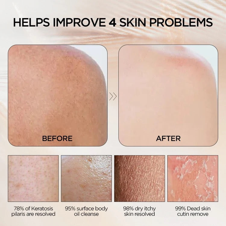 Exfoliating Gloves Bundle - Buy two and Save