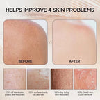 Exfoliating Gloves-#1 Viral Product for Radiant Skin